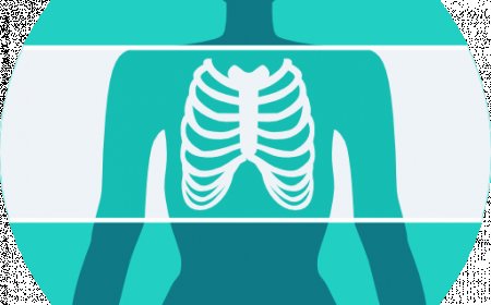 निजी एक्स-रे एवं रेडियोलॉजी सेन्टरों से अनुबंध के लिए आवेदन आमंत्रित